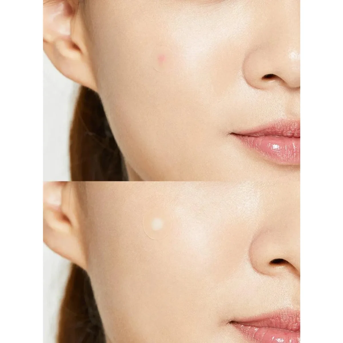 COSRX - Acne Pimple Master Patch - 24 Patches