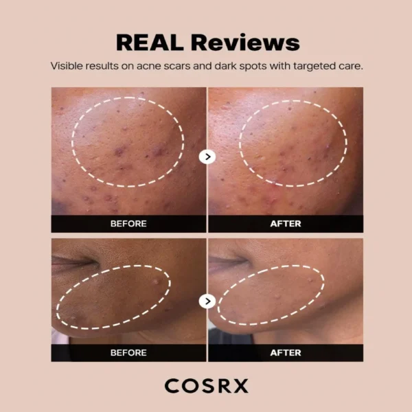 COSRX - The Alpha-Arbutin 2 Discoloration Care Serum - 50ml