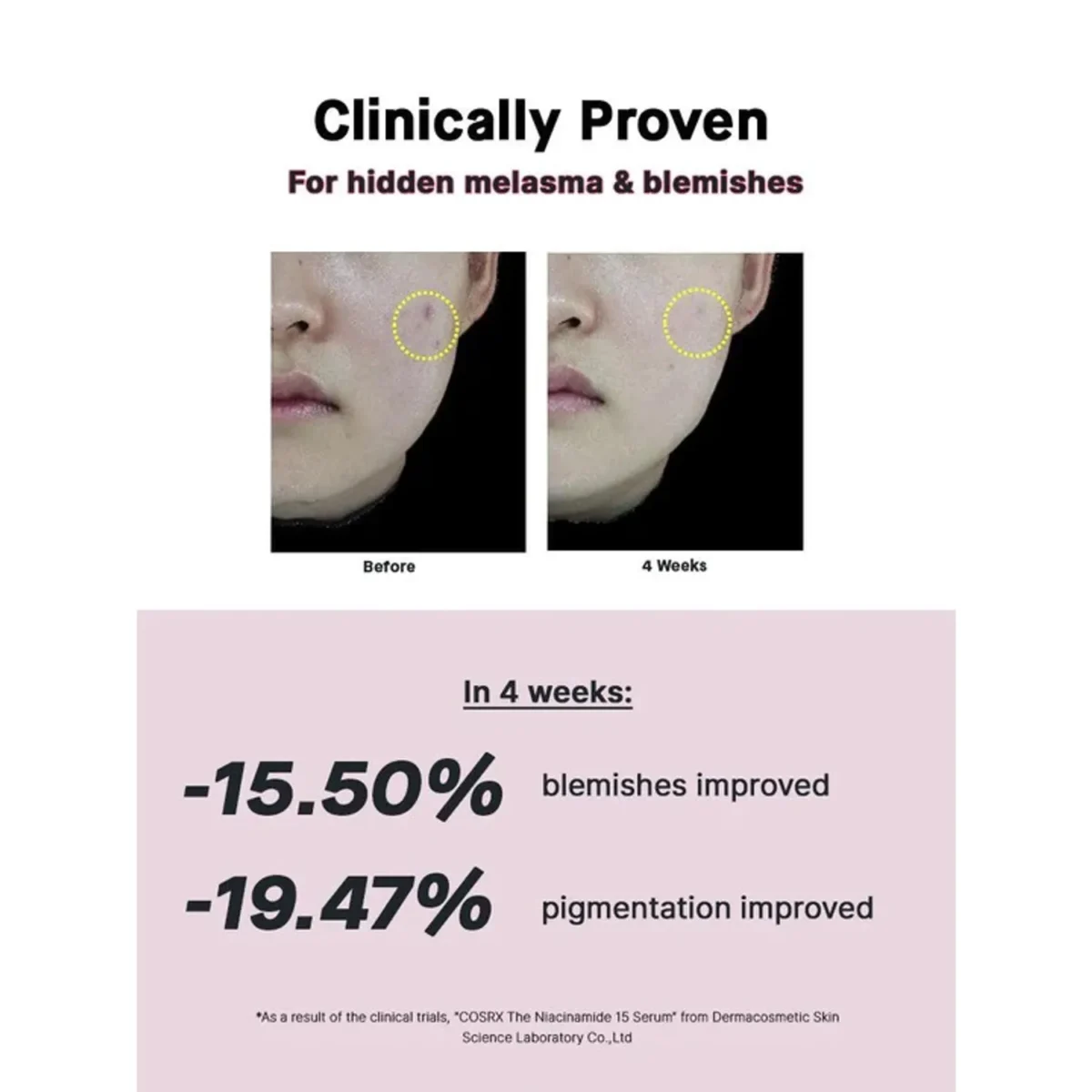 COSRX - The Niacinamide 15 Serum - 20ml