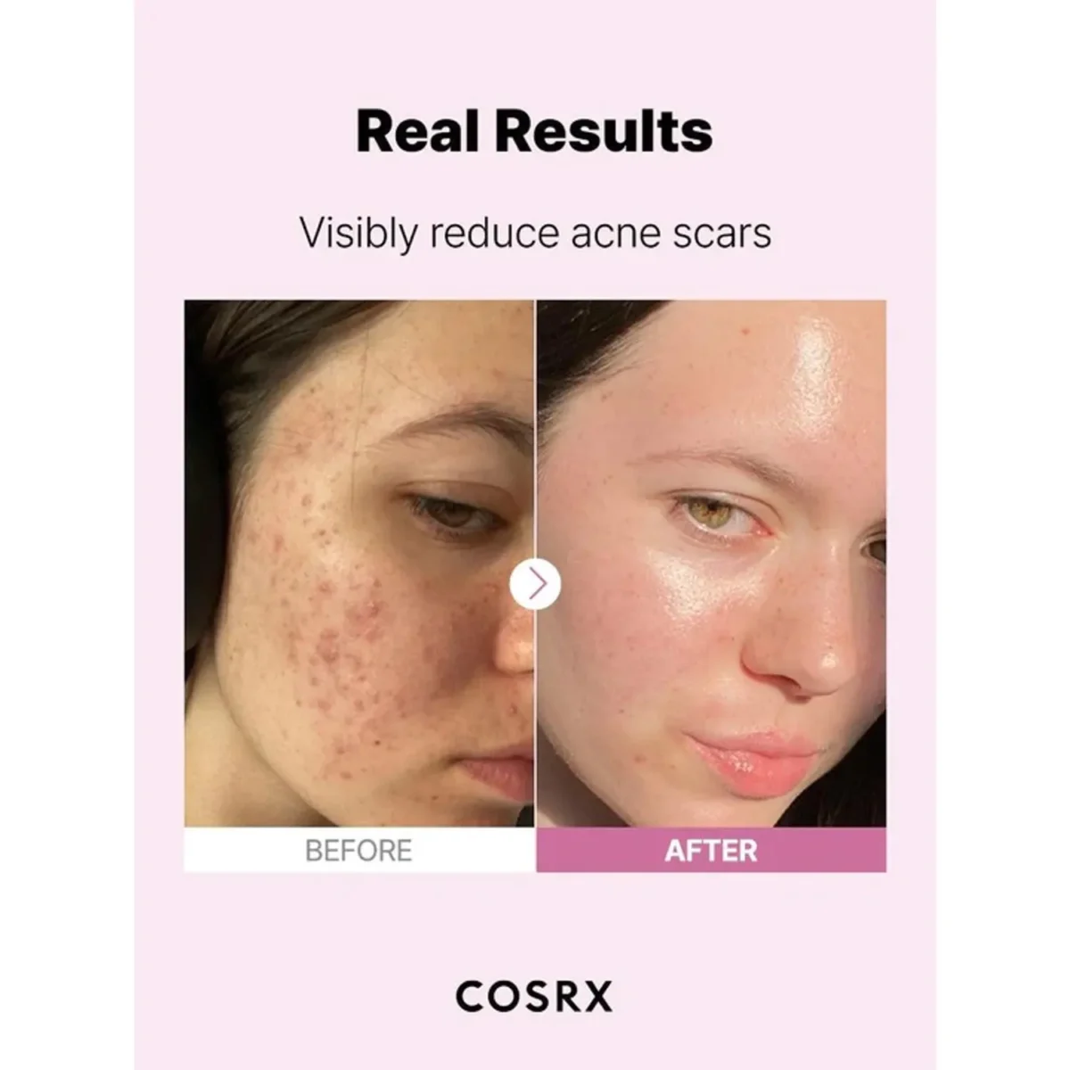 COSRX - The Niacinamide 15 Serum - 20ml