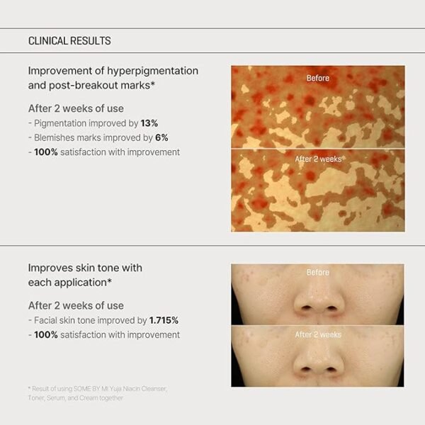 SOME BY MI - Yuja Niacin Anti Blemish Cream - 60g