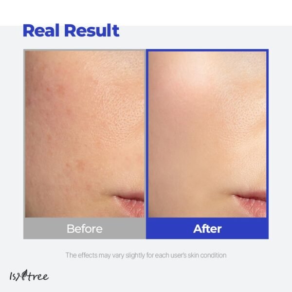 Isntree - Hyaluronic Acid Aqua Gel Cream - 100ml